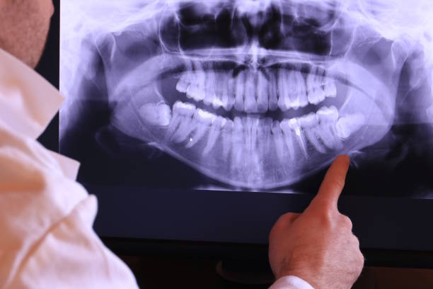 Best Emergency Tooth Extraction in Brookshire, TX