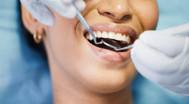 Best Emergency Tooth Extraction in Brookshire, TX