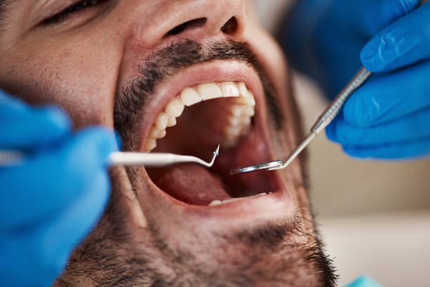 Best Emergency Tooth Extraction in Brookshire, TX
